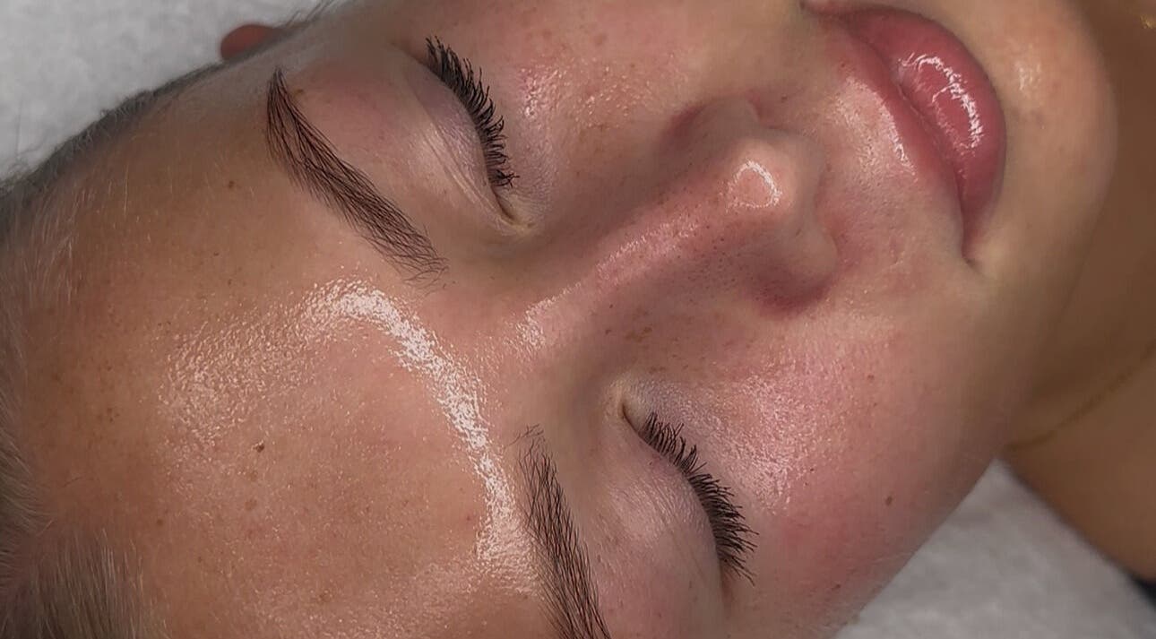 Close-up of glowing skin after facial at Sofia’s Skin Space, Louth, England, GB.