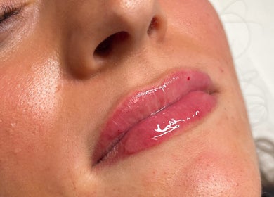 Glossy lips treatment at Aesthetics By Anna, Southport, England, GB showcasing vibrant shine and smooth skin.