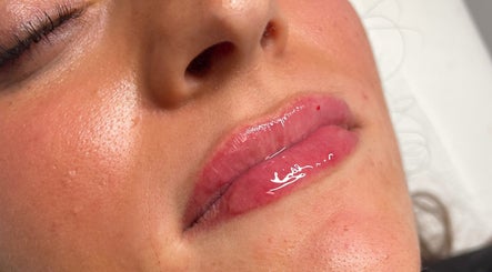 Glossy lips treatment at Aesthetics By Anna, Southport, England, GB showcasing vibrant shine and smooth skin.