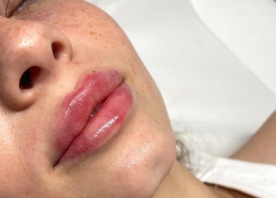Close-up of glossy lips after treatment at Aesthetics By Anna, Southport, England, GB.