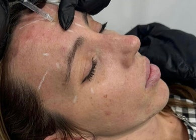 Facial treatment in progress at Aesthetics By Anna, Southport, England, GB, highlighting expert care.