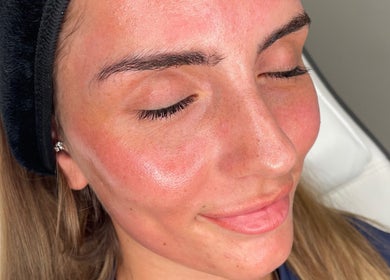Relaxed client with glowing skin at Aesthetics By Anna, Southport, England, GB.