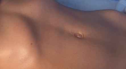 Lyndzees Lymphatics image 3