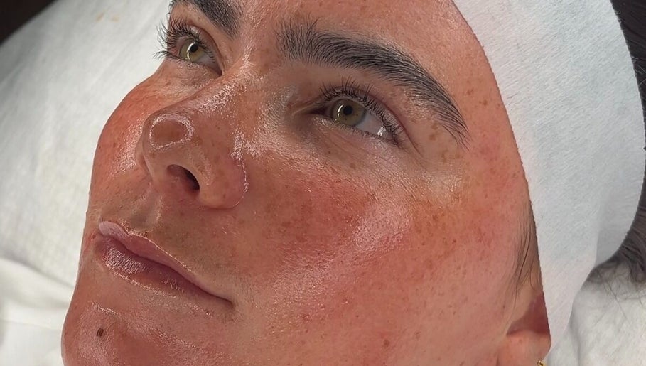 Skin Diary By Toyah, bilde 1