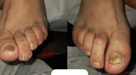 Podologia Tamara obrázek 2