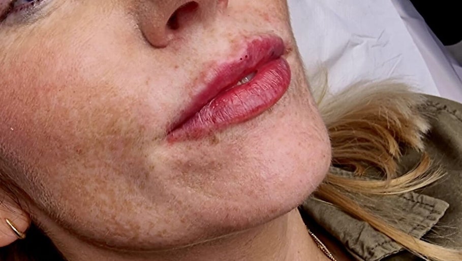 CDH Aesthetics image 1