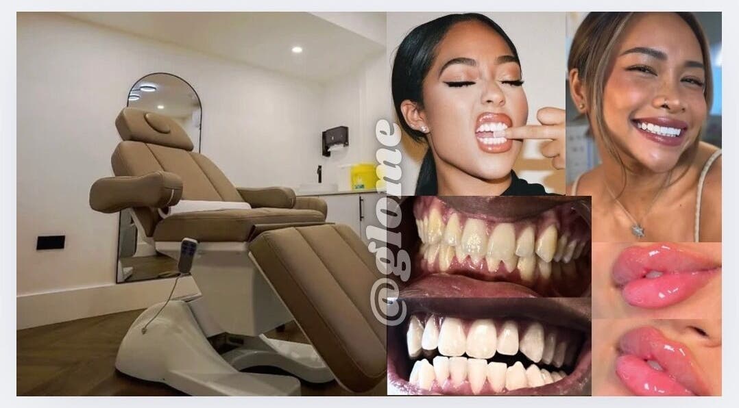 GLOME beauty chair with radiant smiles and teeth transformations, London, England, GB.