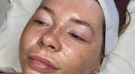 Close-up of fresh, radiant skin post-treatment at Your Skin Club, Wakefield, England, GB.