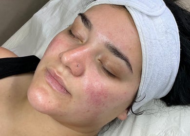 Relaxed woman after a facial treatment at Your Skin Club, Wakefield, England, GB.
