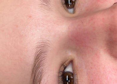 Close-up of a smooth, radiant complexion after treatment at Honey Glow Beauty, Port Macquarie, New South Wales, AU.