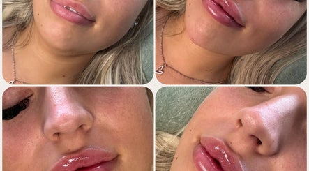 Close-up of glossy lips and radiant skin at NB Beauty, Perth, Scotland, GB.