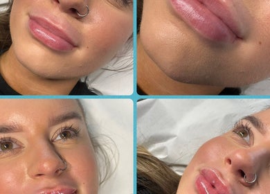 Close-up of a woman's enhanced lips and radiant skin at NB Beauty, Perth, Scotland, GB.