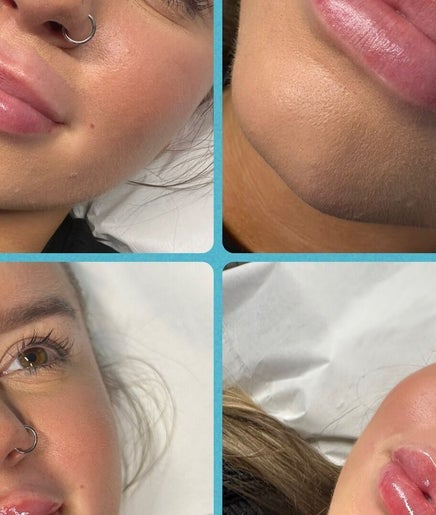 Close-up of a woman's enhanced lips and radiant skin at NB Beauty, Perth, Scotland, GB.