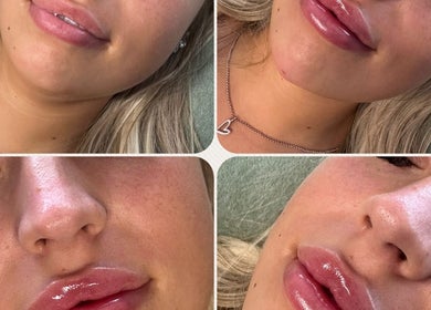 Close-up of glossy lips after treatment at Belle Beauty, Perth, Scotland, GB.