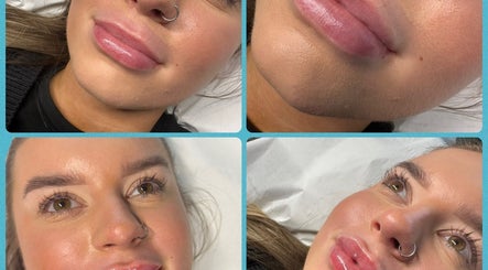 Close-up of lip enhancement at Belle Beauty, Perth, Scotland, GB showcasing glossy and natural finish.