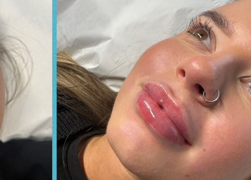 Woman with glowing skin at Belle Beauty & Aesthetics, Perth, Scotland, GB after treatment.