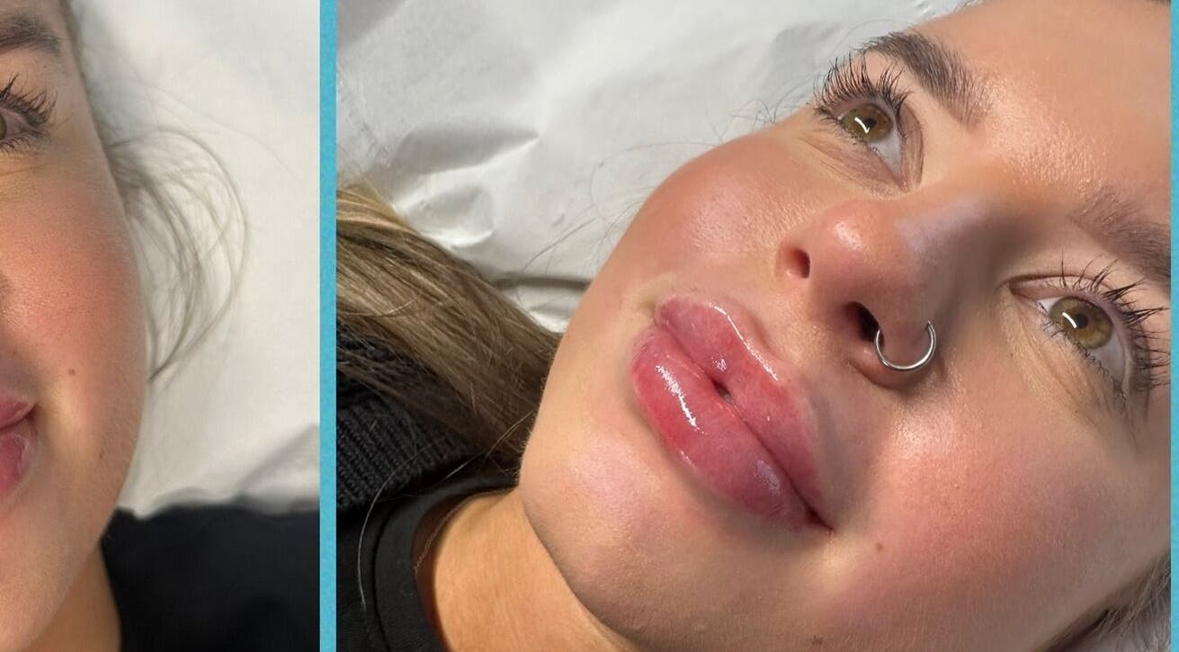 Woman with glowing skin at Belle Beauty & Aesthetics, Perth, Scotland, GB after treatment.