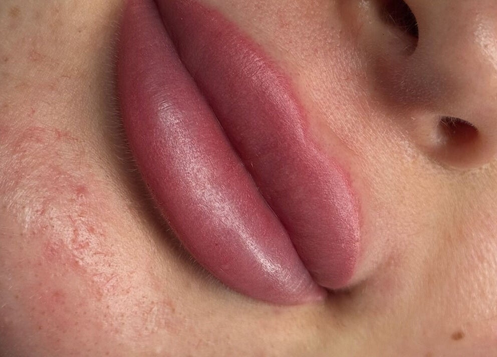 Close-up of enhanced lips at Defined Cosmetics in Labrador, Queensland, AU, showcasing beauty results.