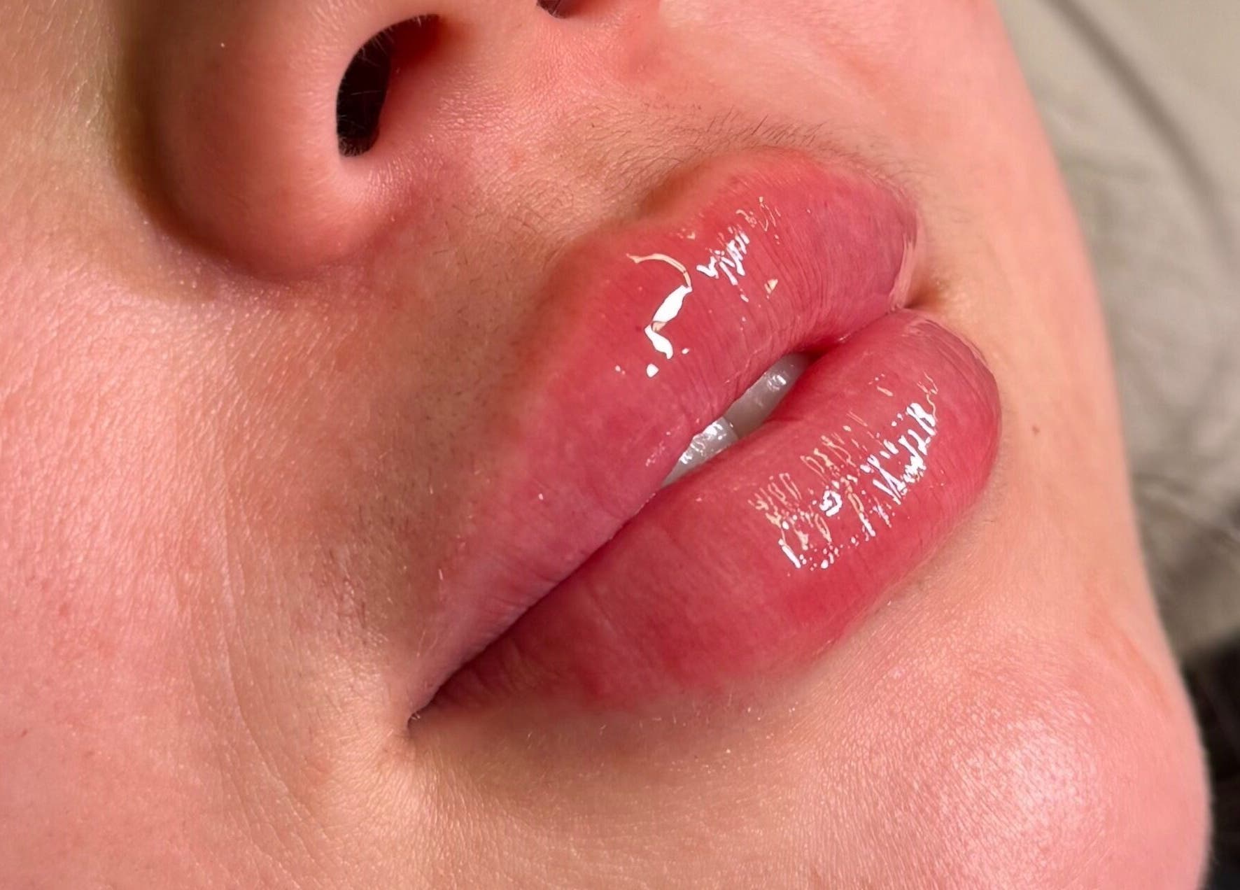 Close-up of glossy lips treatment at Injexed Aesthetics & Wellness, Lytle, Texas, US.
