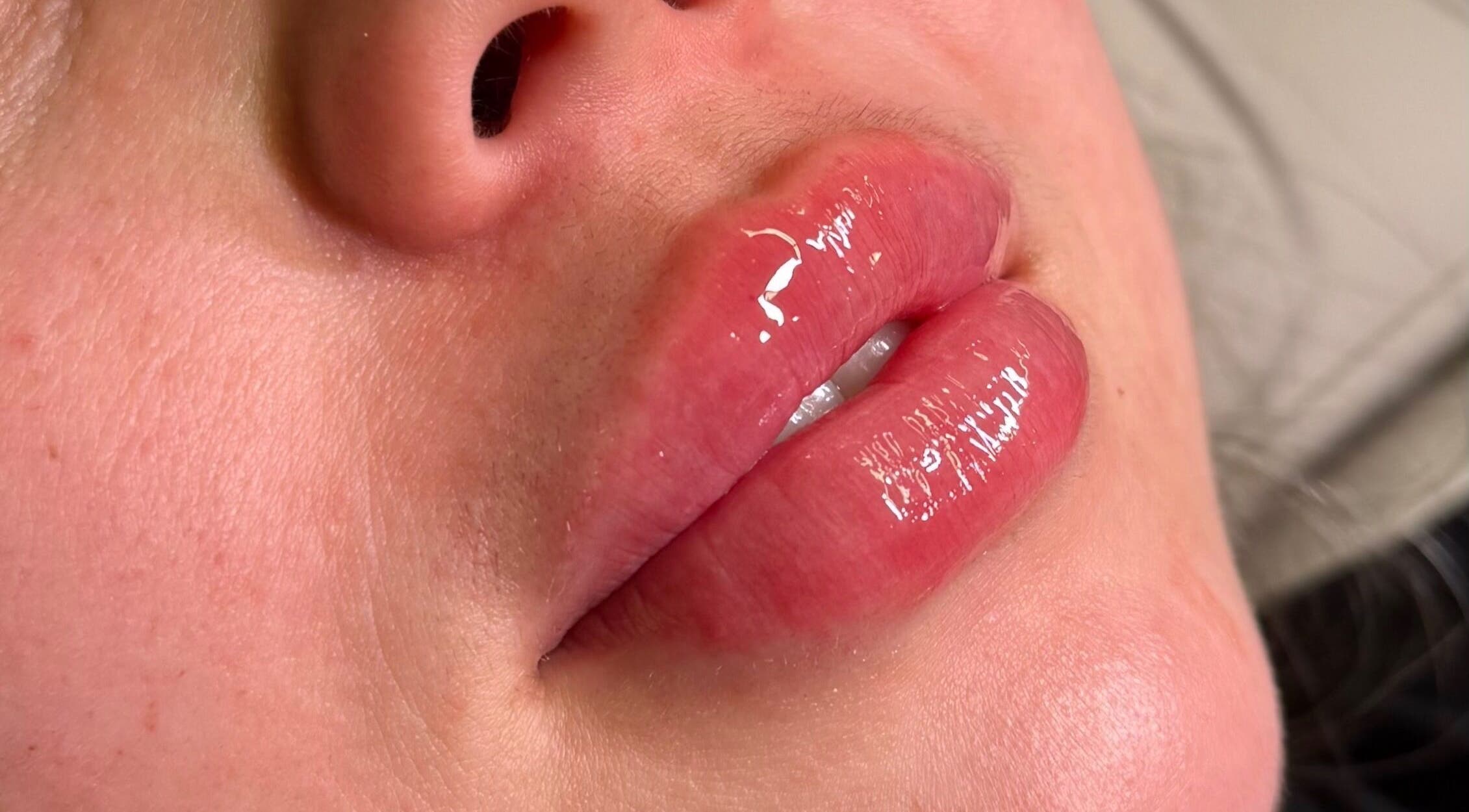 Close-up of glossy lips treatment at Injexed Aesthetics & Wellness, Lytle, Texas, US.