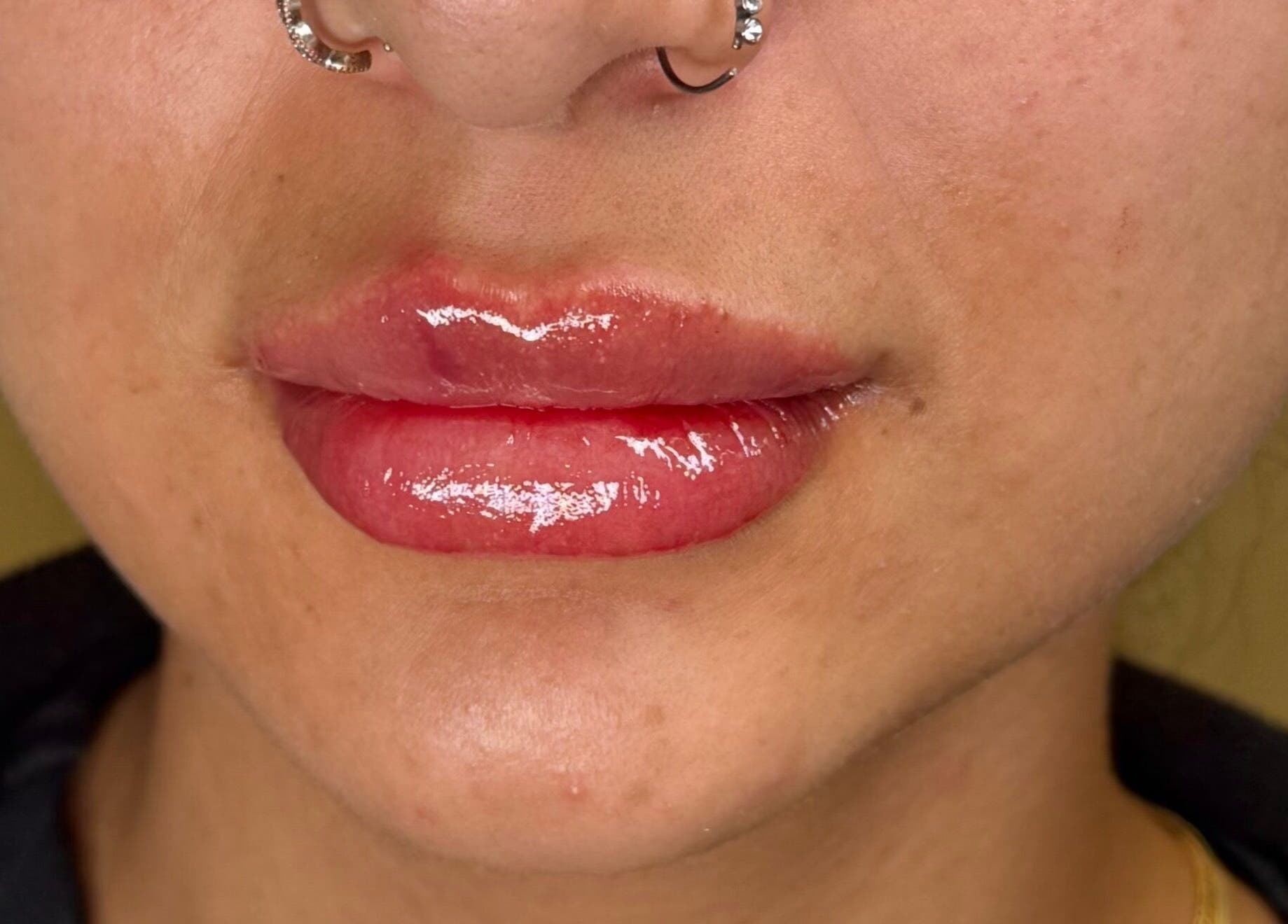 Beautifully enhanced lips with gloss at Injexed Aesthetics & Wellness, Lytle, Texas, US.