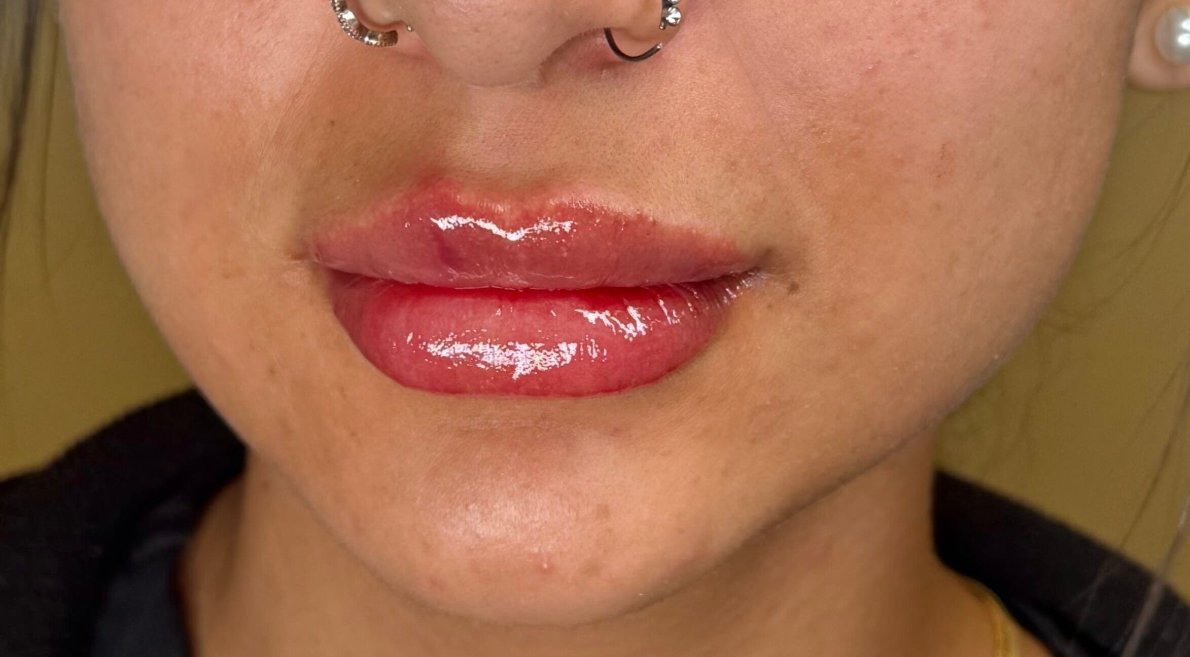 Beautifully enhanced lips with gloss at Injexed Aesthetics & Wellness, Lytle, Texas, US.