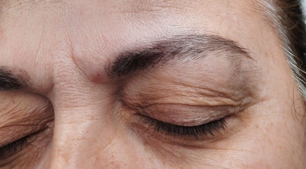 BSN Estética, bilde 2