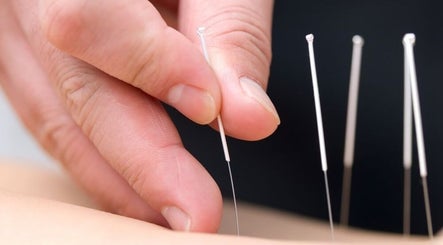 Rebalance Qi Acupuncture (Papatoetoe)