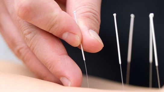 Rebalance Qi Acupuncture (Papatoetoe)