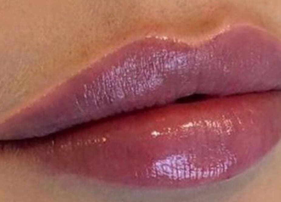 Glossy pink lips at Redefined Aesthetics & Skin in Bargoed, Wales, GB, showcasing vibrant beauty treatments.