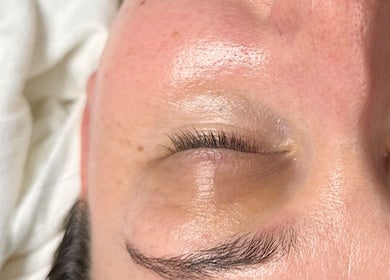 Close-up of radiant skin after treatment at A.B. SKINCARE STUDIO, Winnipeg, Manitoba, CA.