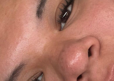 Close-up of glowing skin post-treatment at Luxe Lash by DK, Newcastle upon Tyne, England, GB.