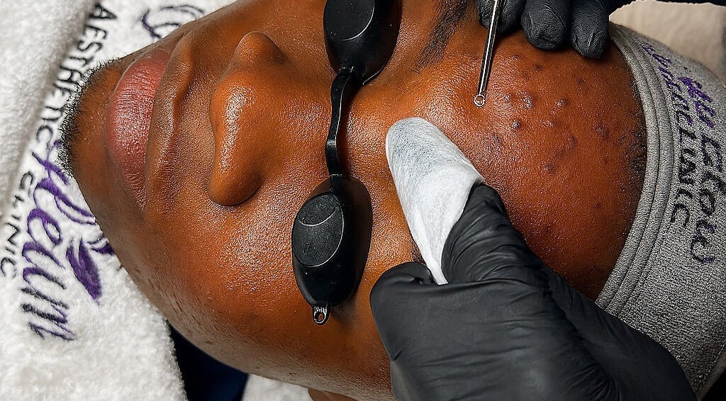 Facial treatment at Monshalasi busstop, Lagos, Lagos, NG enhancing skin glow and pore cleansing.