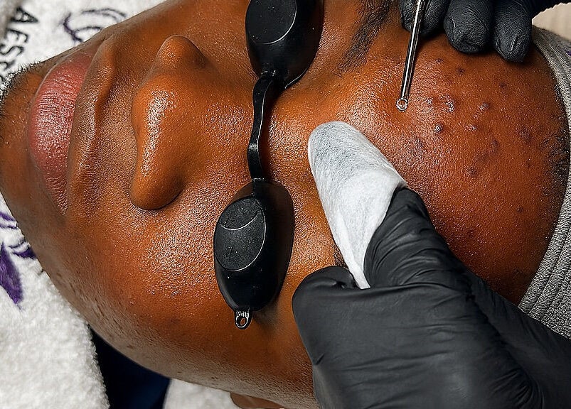 Skincare treatment in progress at Xtragleam Aesthetic Clinic, Ishara, Ogun State, NG.