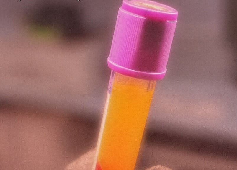A vibrant serum vial at Xtragleam Aesthetic Clinic, Ishara, Ogun State, NG, showcasing skincare innovation.