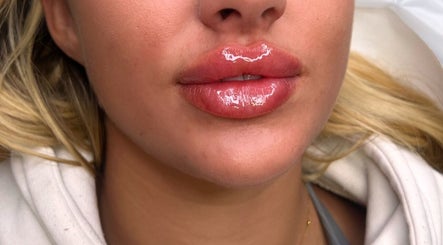 Gigi Aesthetics imej 2