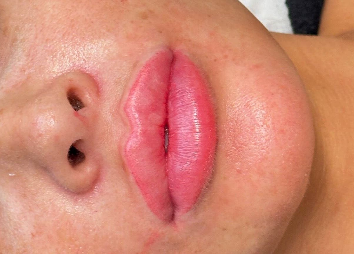 Close-up of enhanced lips at Sian Louisa x Clapham Junction in London, England, GB.