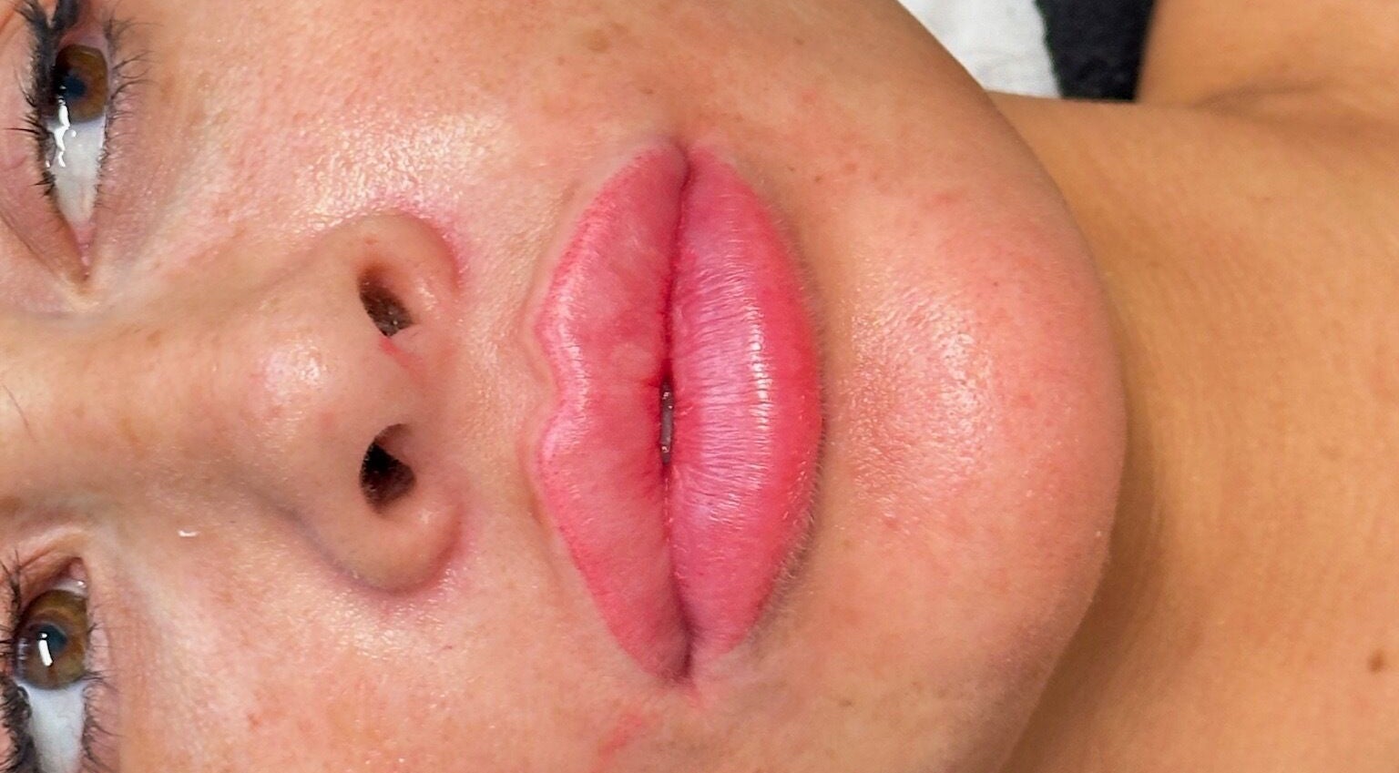 Close-up of enhanced lips at Sian Louisa x Clapham Junction in London, England, GB.