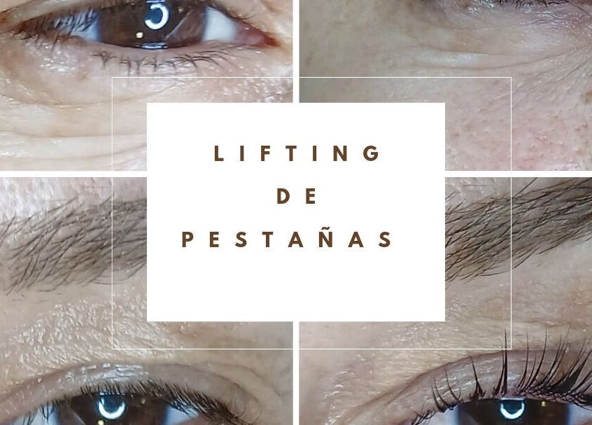 Lifting de pestañas en Estética Avanzada Inma Billón, Palma, Illes Balears, ES, mostrando resultados detallados.