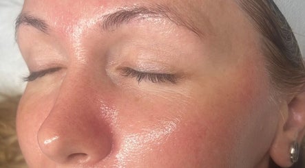 Close-up of a glowing face with smooth skin after treatment at Refresh Skin Therapy, Southampton, England, GB.
