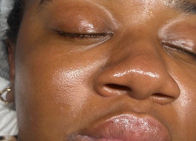 Close-up of glowing skin post-facial at Refresh Skin Therapy, Southampton, England, GB.