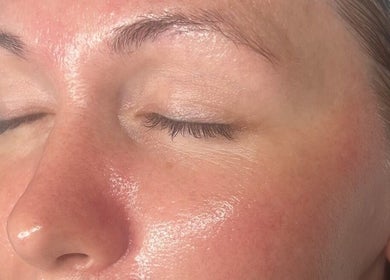 Close-up of a refreshed face after a skin treatment at Refresh Skin Therapy, Southampton, England, GB.