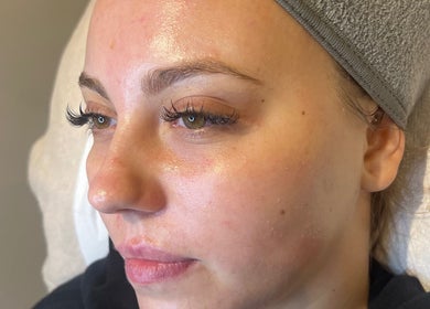 Close-up of a relaxed woman receiving skin treatment at Refresh Skin Therapy, Southampton, England, GB.