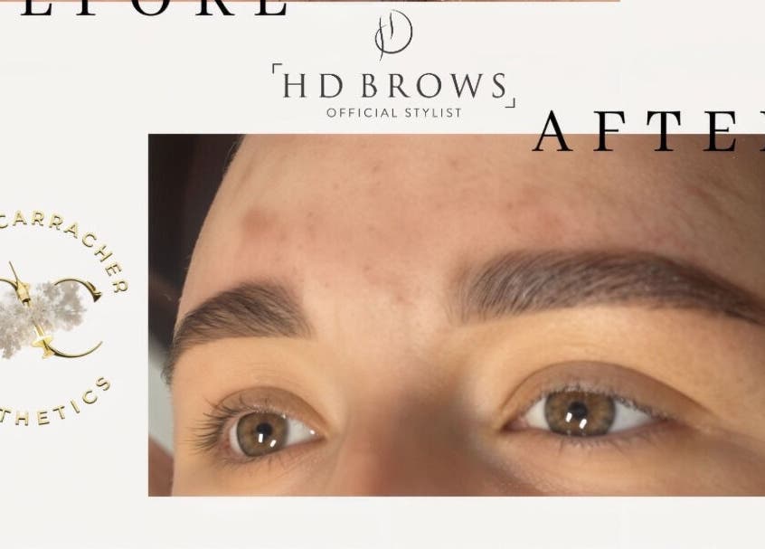 HD Brows treatment at Aesthetics By Paige, Newry, Northern Ireland. Before and after eyebrow results.