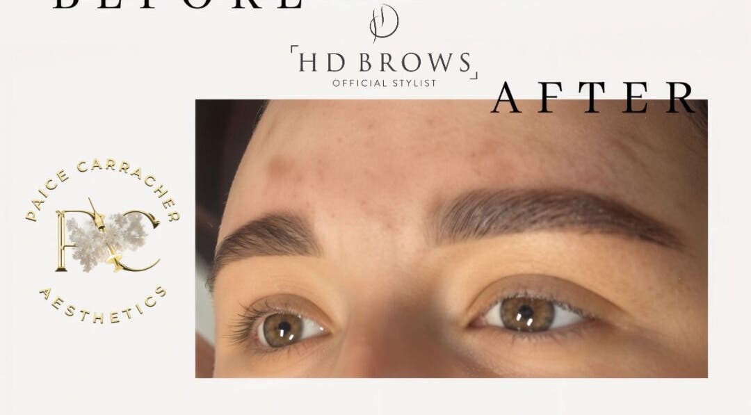 HD Brows treatment at Aesthetics By Paige, Newry, Northern Ireland. Before and after eyebrow results.
