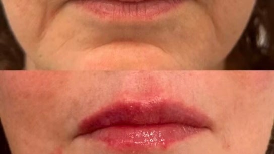 CBMEDCLIN Médico Esthétique Brésilienne