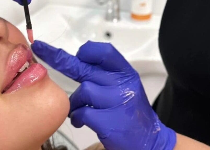 Application de gloss à Spa Médico Esthétique Brésilienne CbMedclin, Longueuil, Québec, CA.