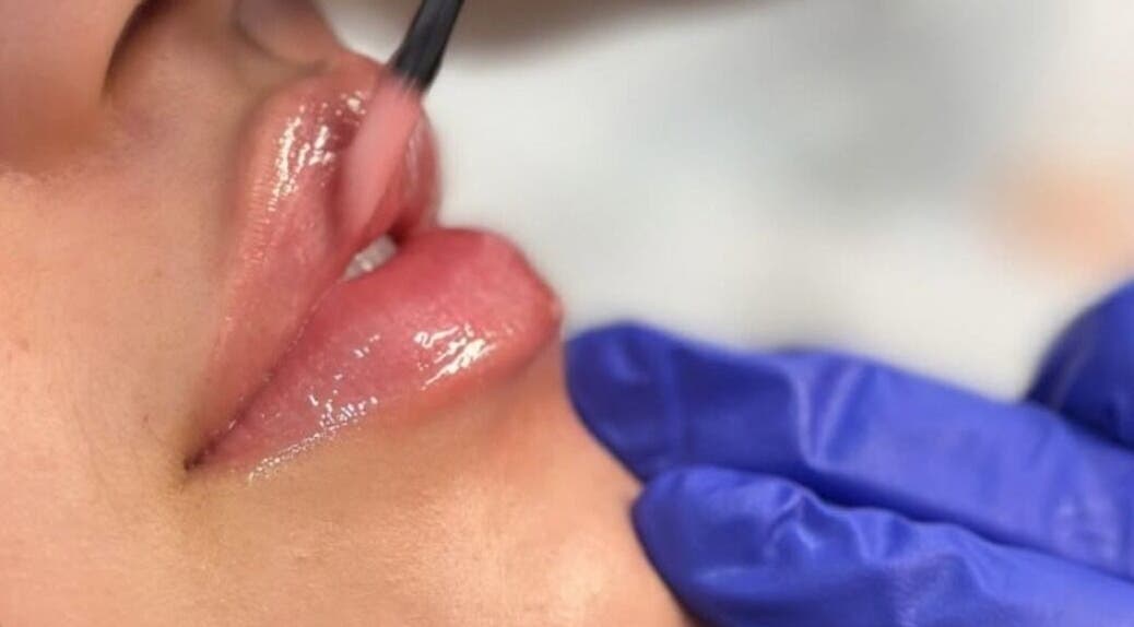 Soin des lèvres à Spa Médico Esthétique Brésilienne CbMedclin, Longueuil, Québec, CA.