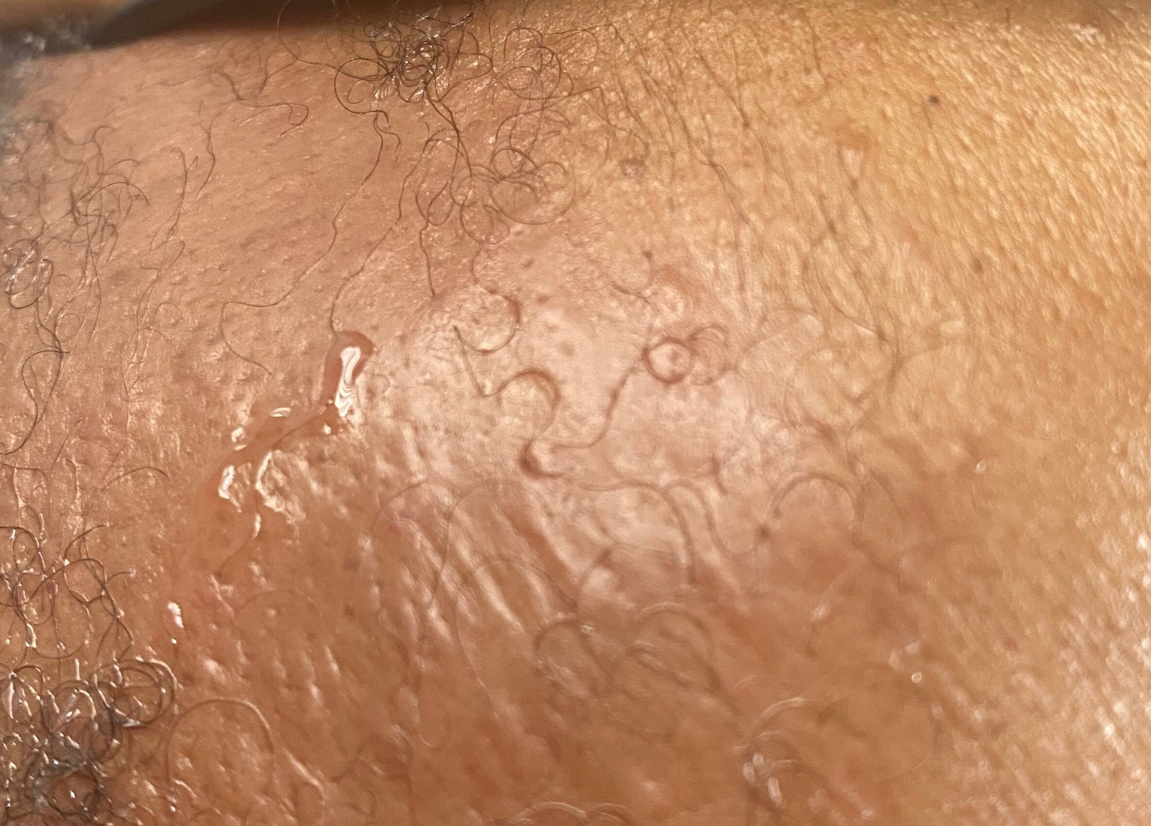 Close-up of glowing, hydrated skin at New You Medical Aesthetics JHB, Sandton, Gauteng, ZA.