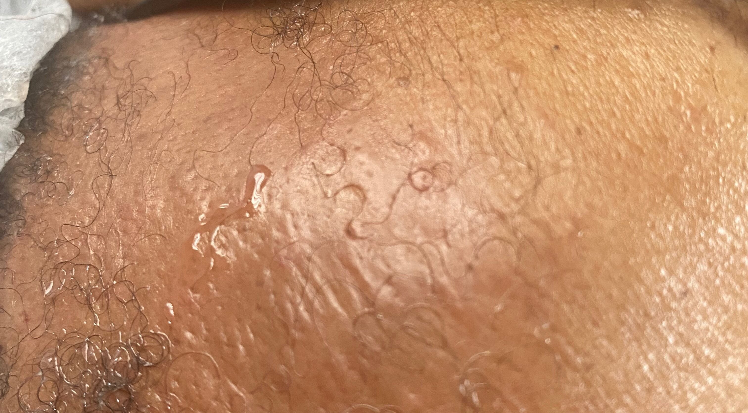 Close-up of glowing, hydrated skin at New You Medical Aesthetics JHB, Sandton, Gauteng, ZA.